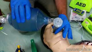 BLS  Supraglottic Airway Device SAD [upl. by Allrud]