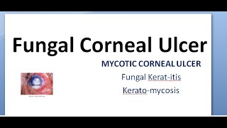 Ophthalmology 115 a Fungal Corneal Ulcer Mycotic Keratitis KeratoMycosis Eye treatment fungus anti [upl. by Paxon]