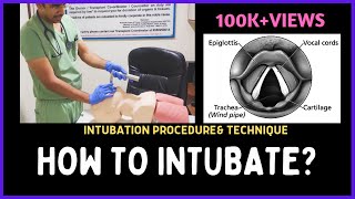 HOW TO INTUBATE INTUBATION PROCEDURE amp TECHNIQUE [upl. by Nolrah956]