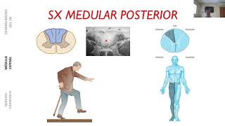 SÍNDROMES MEDULARES [upl. by Ycnan]