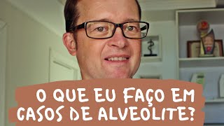 O que eu faço em casos de alveolite  Prof Mauricio Volkweis [upl. by Mikal]