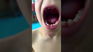 First tooth falls out [upl. by Julieta]