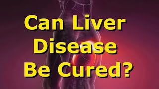 Can Liver Disease Be Cured [upl. by Land]