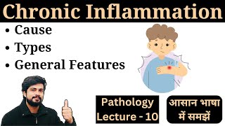 Chronic Inflammation in Hindi  Types Cause General Features  Pathology Lecture Notes [upl. by Tuck]