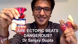 Are ectopic heart beats dangerous [upl. by Kearney]