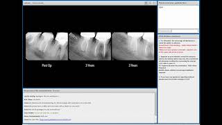 VDW Dental · Webinar The Endodontic Essentials with Dr Marino Sutedjo EN [upl. by Etnwahs]