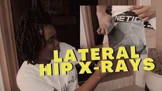 Lateral Hip Xray Positioning amp Centering Tips w Demo  Ask The Rad Tech [upl. by Otrebor790]