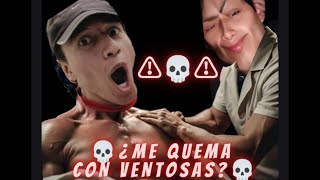 ⚠️🔥¿QUEMARÉ a mi COMPA Usando VENTOSAS por PRIMERA VEZ en ESPALDA 🔥⚠️ [upl. by Robenia]