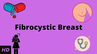 Fibrocystic Breast Causes Signs and Symptoms Diagnosis and Treatment [upl. by Annazor]