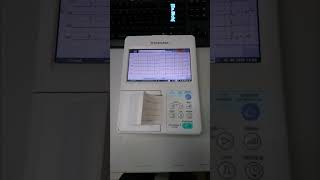 Fukuda Denshi FX8100  How to test Electrocardiography Cách test Máy đo điện tim Fukuda fukuda [upl. by Julieta]