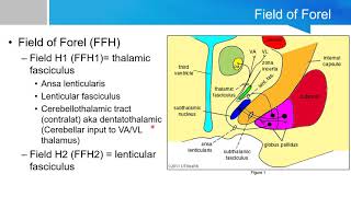 Neurosurgery written board crash course  basal ganglia part 2 [upl. by Ondrea]