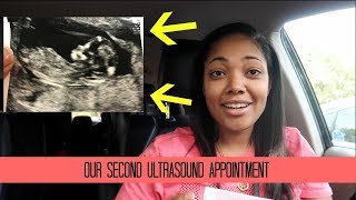 OUR SECOND ULTRASOUND APPOINTMENT [upl. by Bethesde]