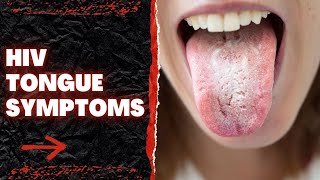 HIV Tongue Symptoms [upl. by Assilana696]