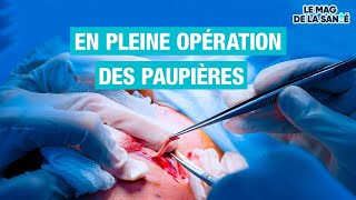 👁️ Une chirurgie pour remonter les PAUPIÈRES  Allo Docteurs [upl. by Stag]