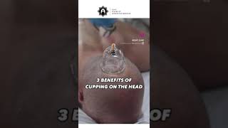 3 BENEFITS of Cupping on the head [upl. by Nabala]