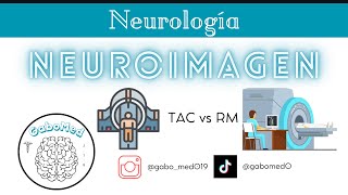 Neuroimagen  ¿Cómo Diferenciar Entre Una TAC Y Una RM [upl. by Manard]