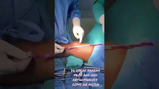 Central quadriceps tendon graft harvest [upl. by Godfry]