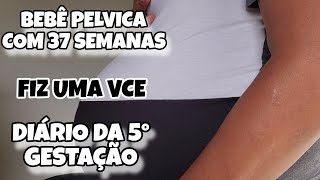 DIARIO DA 5° GRAVIDEZ ‐ MELISSA RESOLVEU SENTAR COM 37 SEMANAS  VCE  36 Á 38 SEMANAS [upl. by Sidnac567]