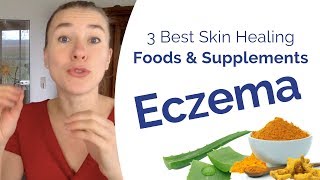 Eczema Treatment  The 3 Best Foods amp Supplements to Boost Your Skin Healing [upl. by Llednahs]