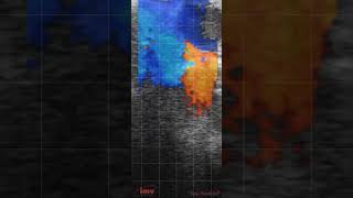 Ecography Doppler in dairy cows [upl. by Lala]