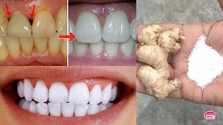 natural ways to whiten your teeth in 5 minutes with ginger and salt [upl. by Edveh]