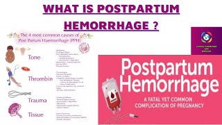 PPH Post partum Hemorrhage  Definition TypesRisk Factors Management [upl. by Jeanette]