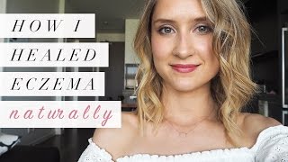 How I Healed Eczema Naturally  My Story [upl. by Darraj]