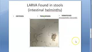 Parasitology 002 d Parasites found Stool examination cyst trophozoite egg adult larva [upl. by Meesak]