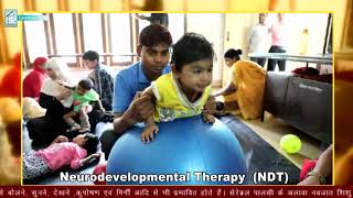 Cerebral Palsy Treatment with MultiModal TherapyPart 1 CP Child Physiotherapy Trishla Foundation [upl. by Pauletta]