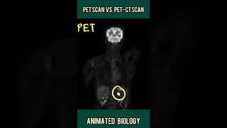 Atulaya Healthcare Launches Advanced Pathology Lab Imaging Center and PET CT Scan at Shimla [upl. by Nilrev]