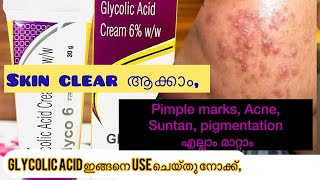 How to use glycolic Acid creamGlyco 6ww Review in malayalam [upl. by Esinal]