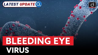 Marburg Virus Outbreak  Latest Update  Drishti IAS English [upl. by Sigrid]