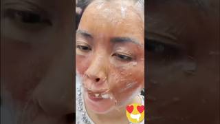 ✅Get Spotless amp clear Skin Remove Dark Spots amp Pigmentation In 7days beautiful shorts viral [upl. by Llemart244]