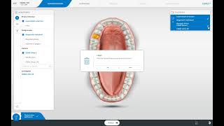 CEREC Software 5 Die Administrationsphase [upl. by Ahsinra]