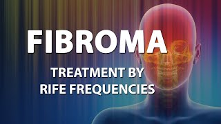 Fibroma  RIFE Frequencies Treatment  Energy amp Quantum Medicine with Bioresonance [upl. by Brindell]