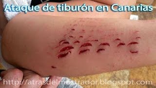 Ataque de Tiburón en España  Las Palmas de Gran Canaria Islas Canarias [upl. by Thurstan]