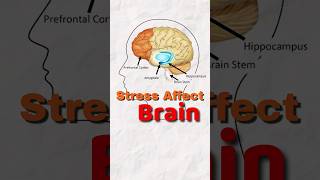 How Stress Affect Your Brain  mentalhealth [upl. by Razatlab]