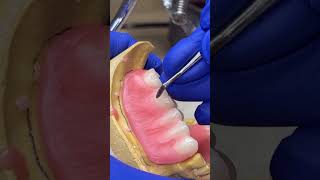 Wax up and carving of maxillary denture dentistry bds shorts viral trending prosthodontics [upl. by Mosira993]