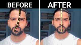 How To Fix Facial Asymmetry amp Jawline  3 Proven Tips  Only Solution [upl. by Eicnan]