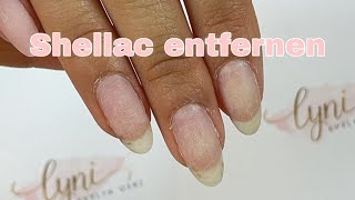 Shellac ablösen mit Remover  Gellack entfernen [upl. by Hinkle188]