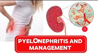 Pyelonephritis causes signs and ways to prevent it [upl. by Kcirnek]