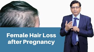 Female Hair Loss After Pregnancy  Ways To Prevent Hair Fall After Pregnancy  Dr Anil Garg [upl. by Edveh]