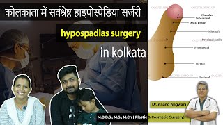 Hypospadias Surgery in Kolkata [upl. by Artema823]