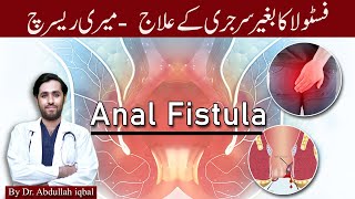 Fistula  What is Perianal Fistula  Fistula Causes Find out Best treatment without surgery [upl. by Aiceled]