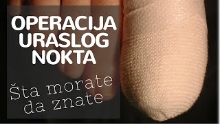 Operacija uraslog nokta urasli noktiju urasli nokti intervencija koliko kosta cena [upl. by Mcevoy]