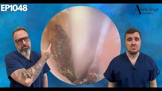 Ear Wax Removal Disaster You Wont Believe  EP1048 [upl. by Sanfo]