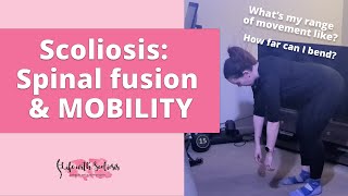 Scoliosis Spinal Fusion and Mobility  Life with Scoliosis [upl. by Ammamaria]