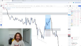 Live Day Trading Losing 5239 IM GETTING EMOTIONAL [upl. by Adnilev403]