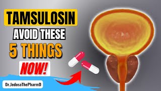 Taking Tamsulosin 5 Things You Must Avoid If You Are Taking Tamsulosin [upl. by Earahs]