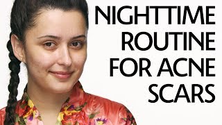 Get Unready With Me Nighttime Routine for Acne Scars  Sephora [upl. by Ronaele]